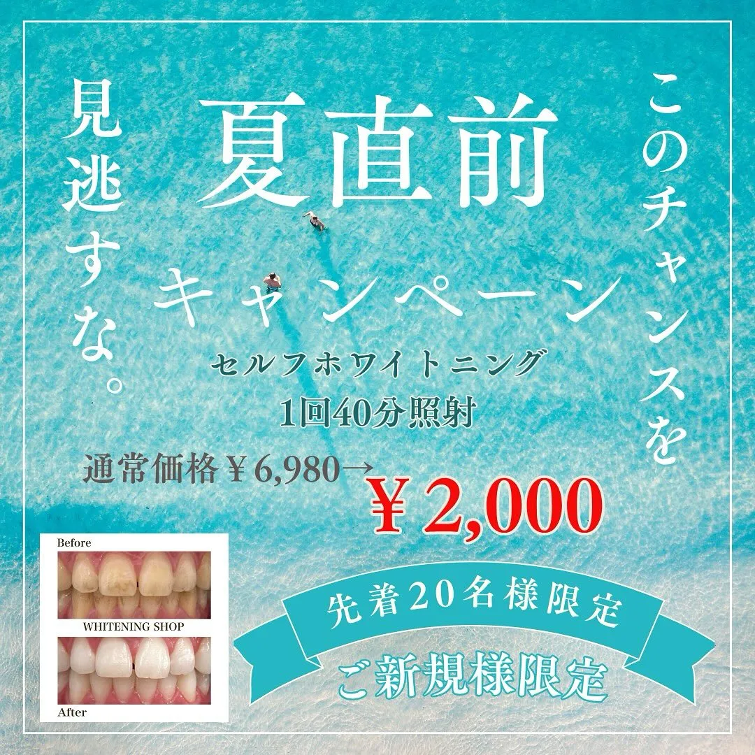 🌴夏もすぐそこ！このチャンスを見逃すな🌞