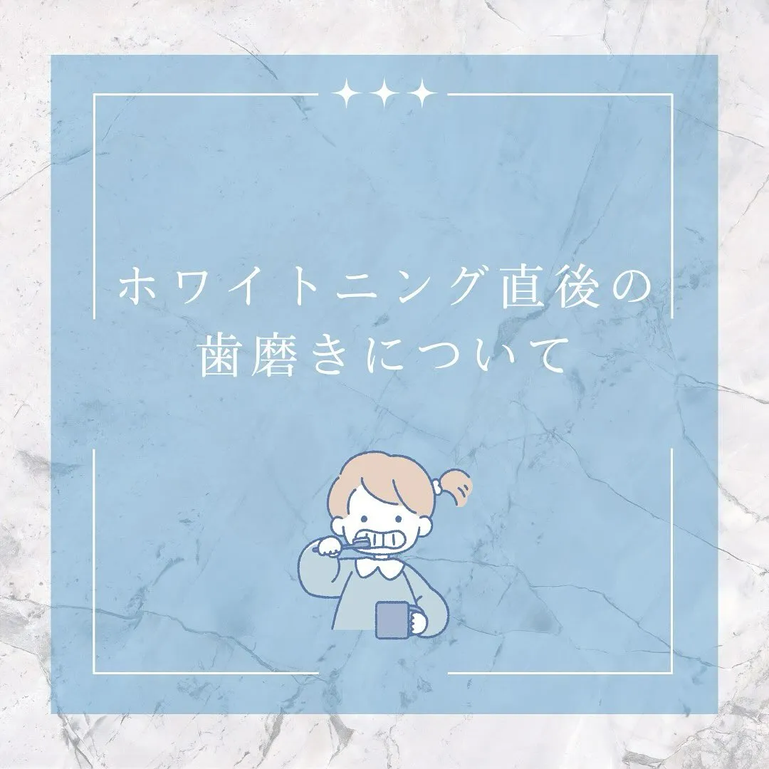 🦷ホワイトニング後の歯磨きポイント✨