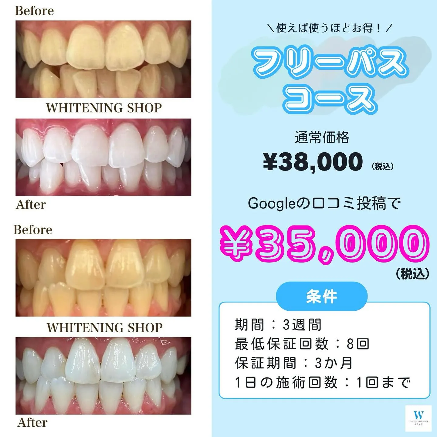 🌸短期集中で白く✨人気のフリーパス登場🦷💖