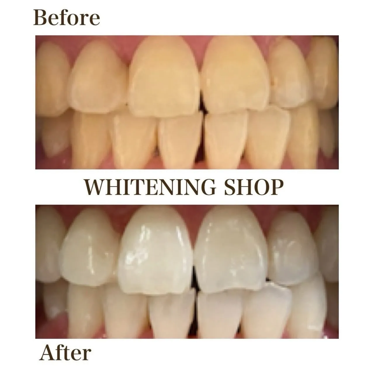 笑顔に自信をプラスしませんか？☺️✨