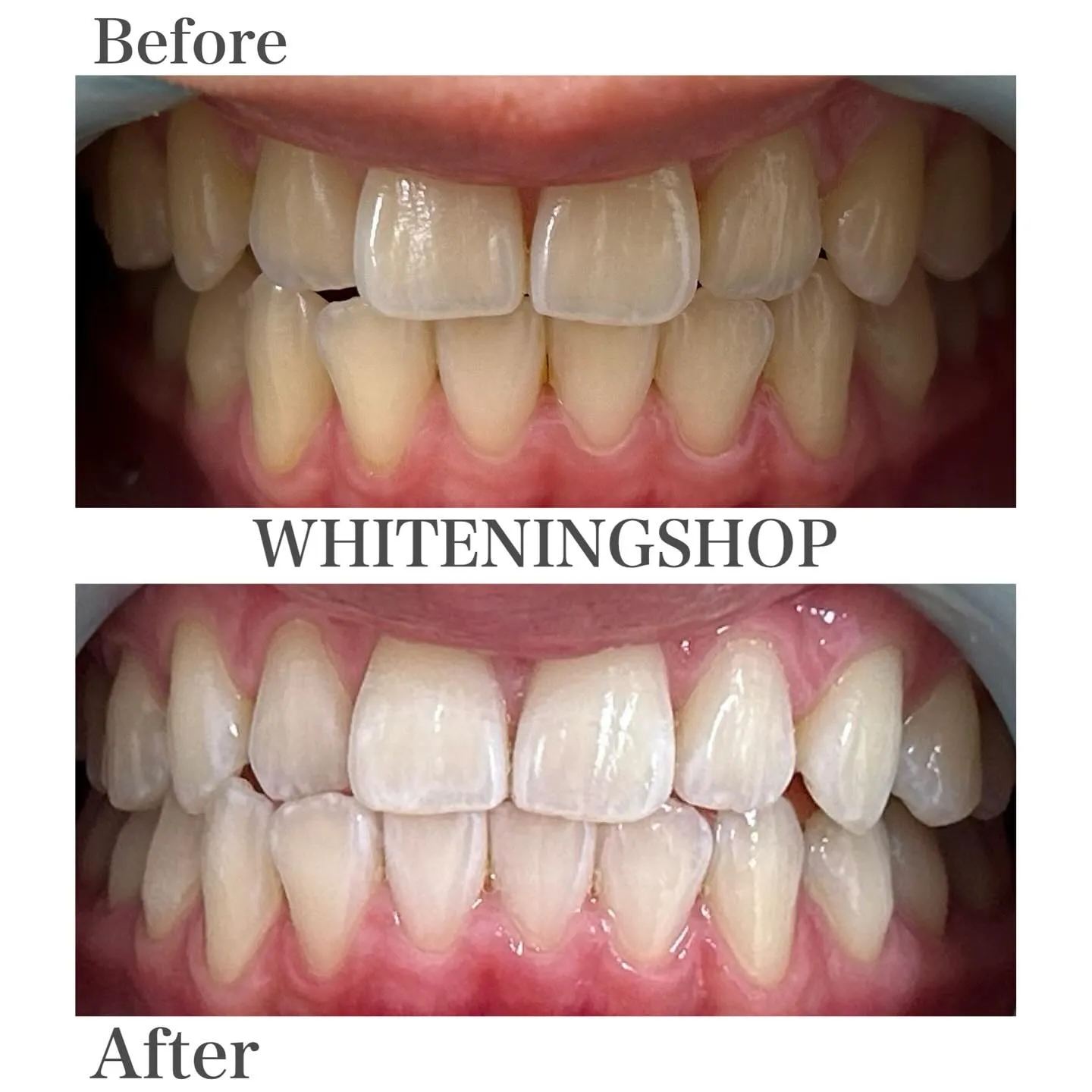 名駅近くで叶える、上質ホワイトニング体験💕