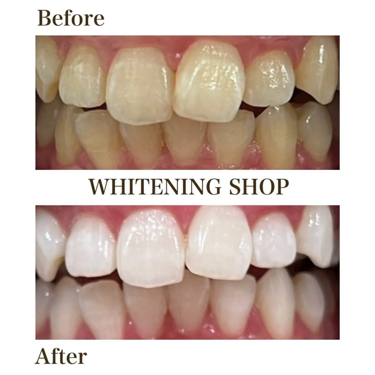 がんばる自分に、“白い歯のご褒美時間”を🕊️