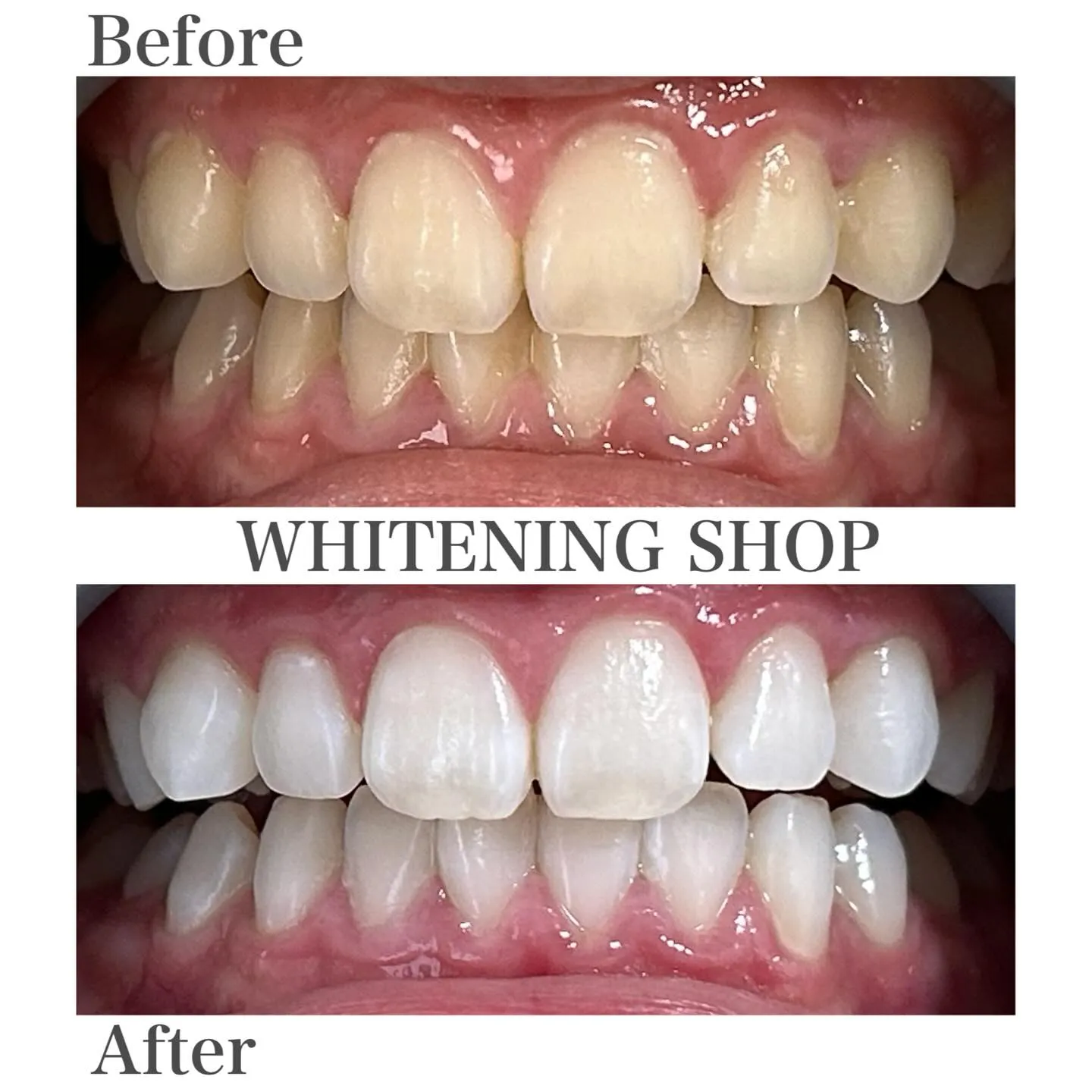 「写真を見返すたび、もっと好きな自分へ📸」