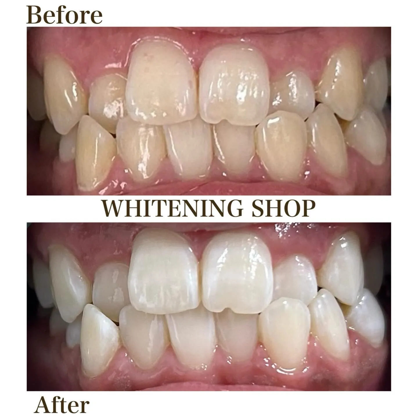 通うたびに嬉しい変化！理想の白さへ✨