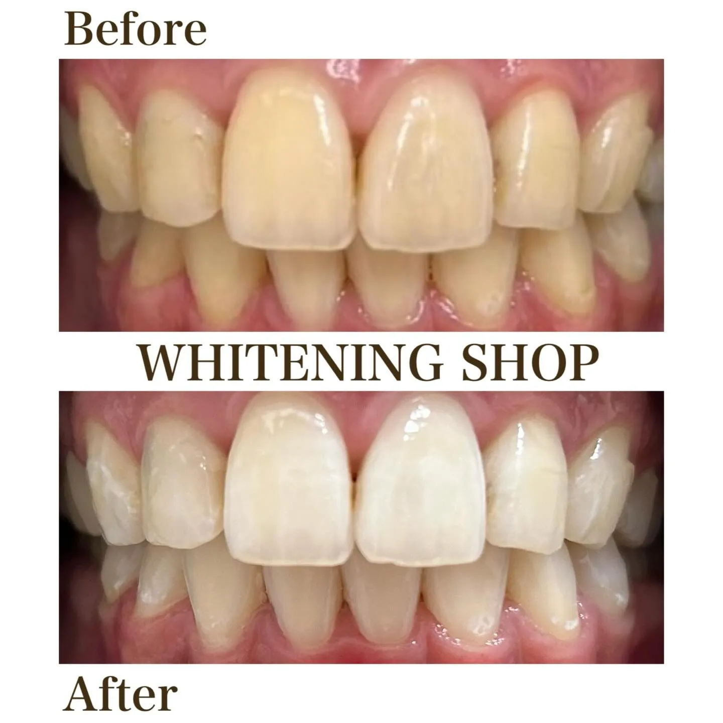 【自分の笑顔に“もっと自信”を✨】