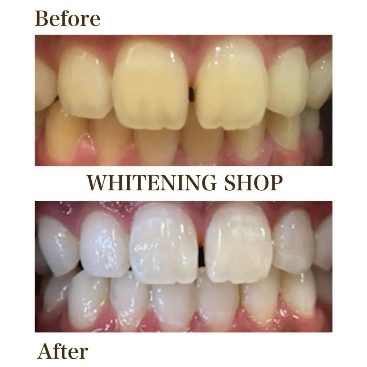 この冬は“透明感”が主役。