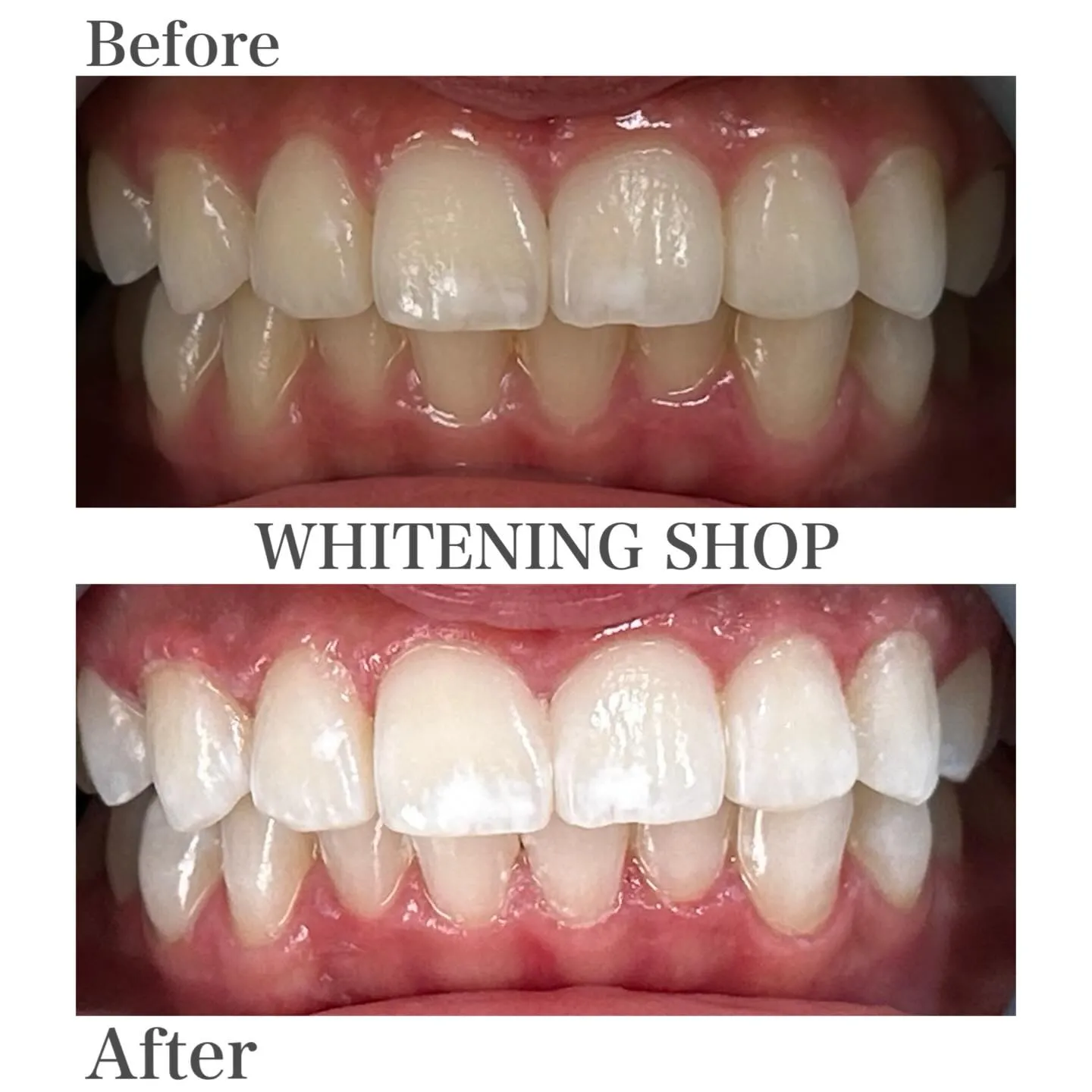 何もしない40分が、いちばんの美容時間🕊️✨