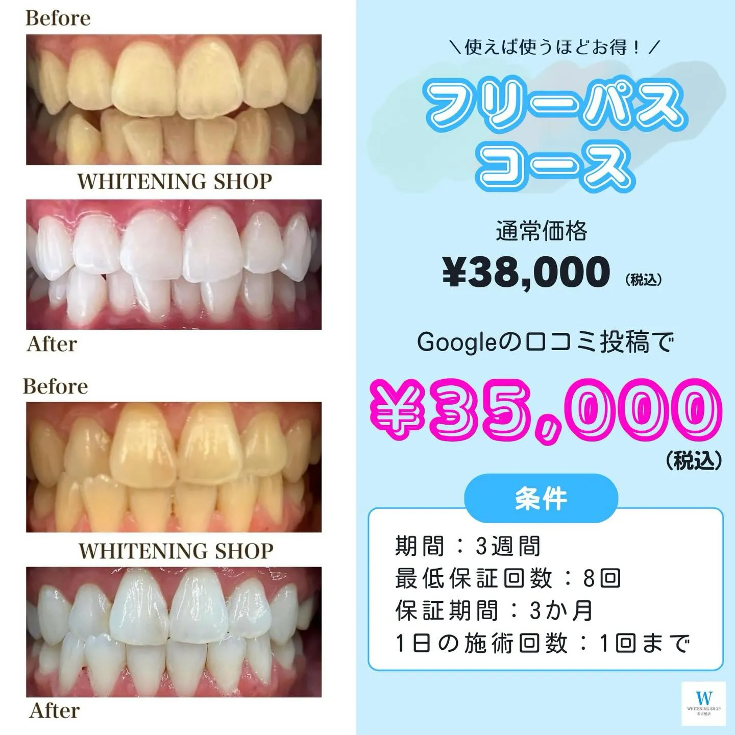 通うほどお得🦷✨短期集中💎3週間フリーパス💖