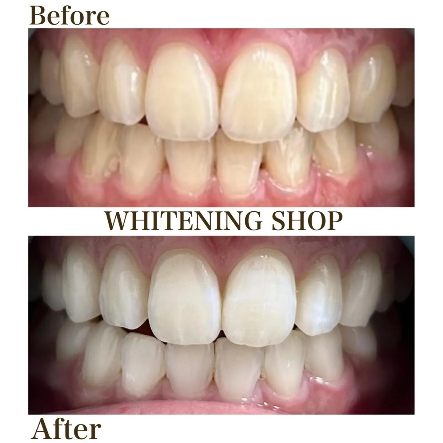 なんか素敵、の理由は口元にある🪄