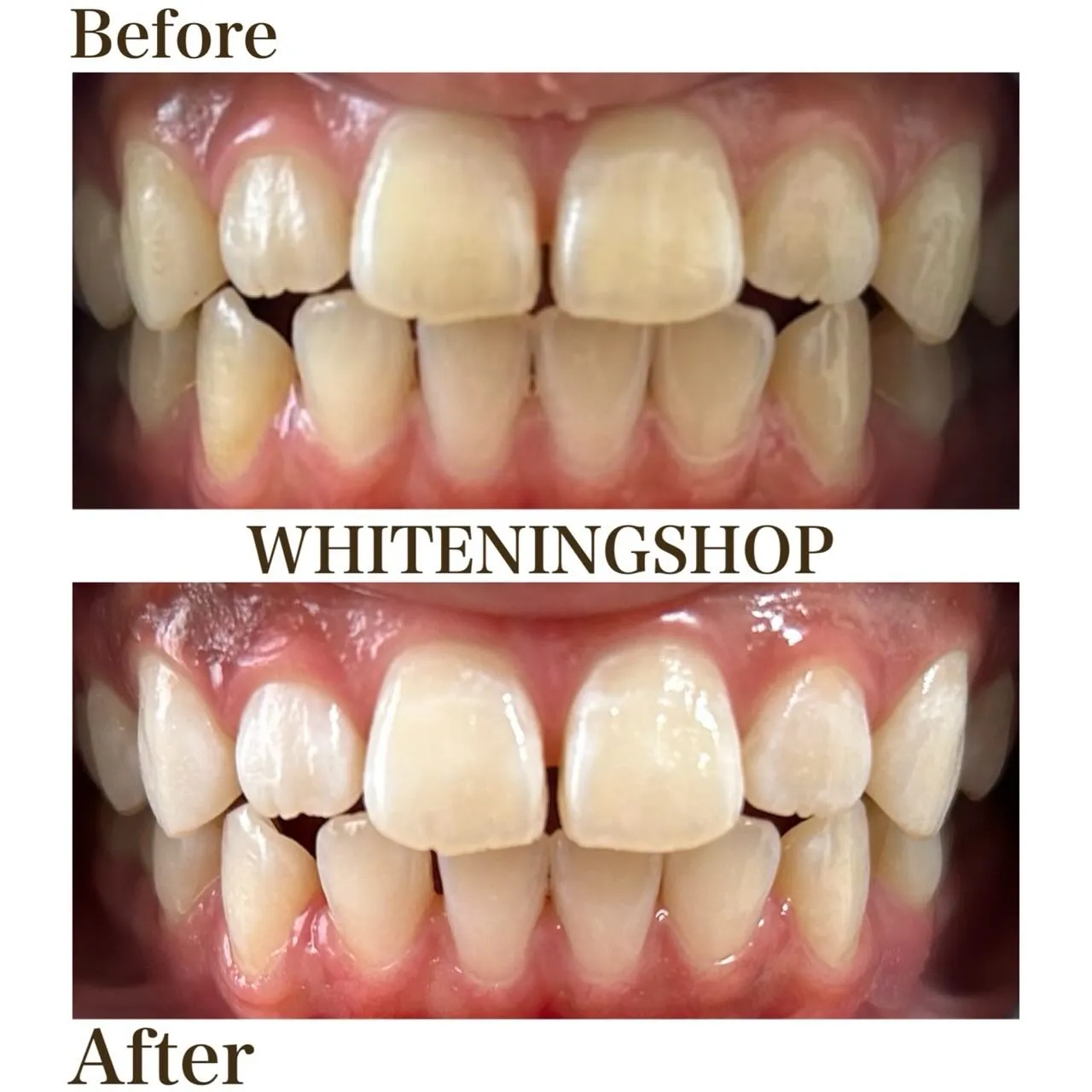 なんか素敵、の理由は口元にある🪄