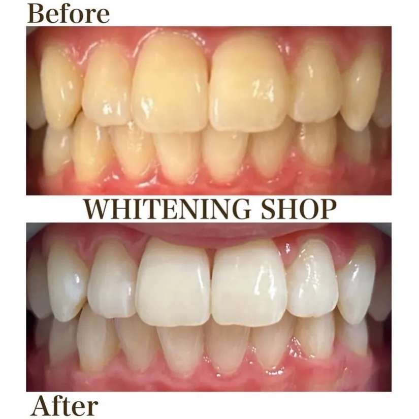 🦷✨\ 歯のツヤ、失われていませんか? /✨🦷