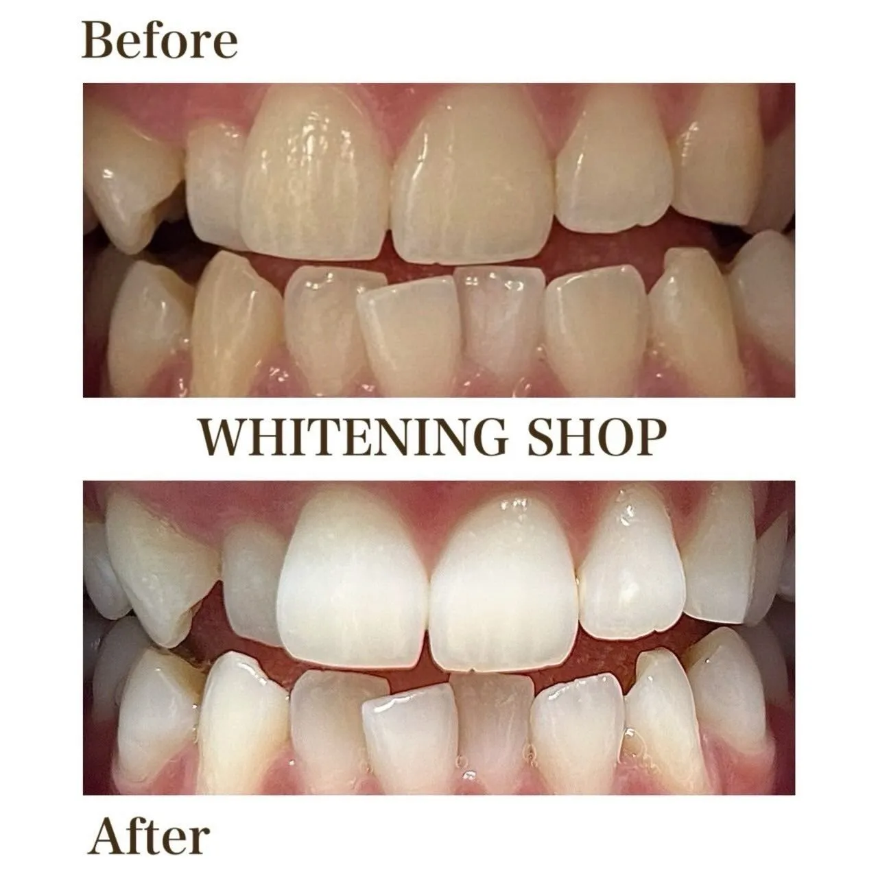 🌿自然な白さで、毎日に自信を🌿