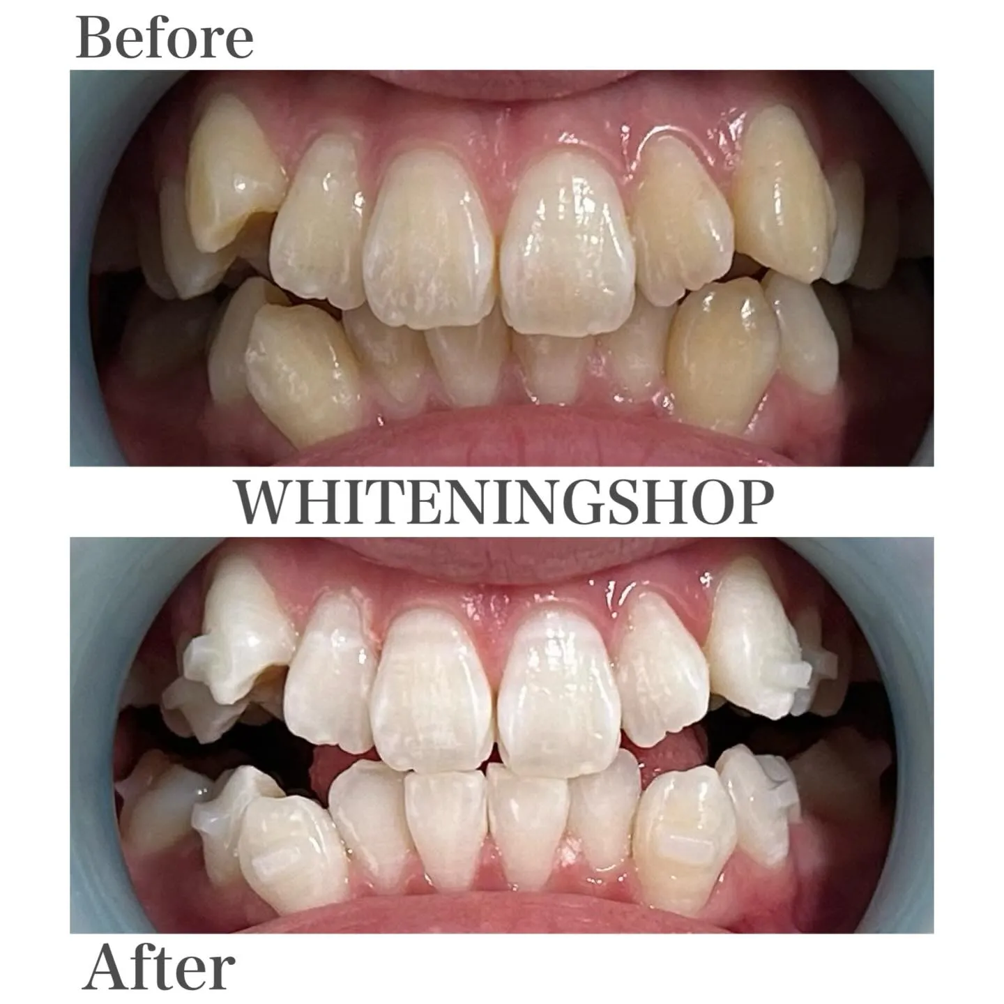 笑顔に、もう迷わない自分へ🪞✨