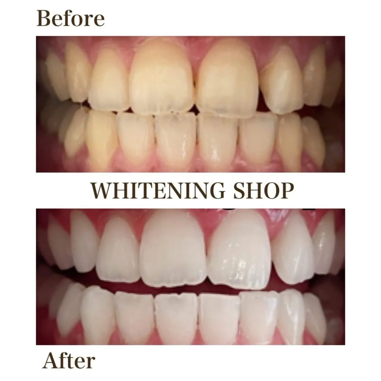 ✨重ねるたび、輝きが増す。