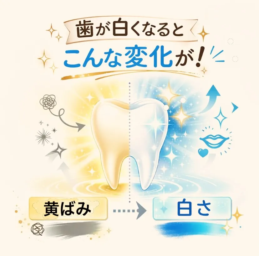 🦷✨ 歯が白くなると、こんな変化が! ✨🦷