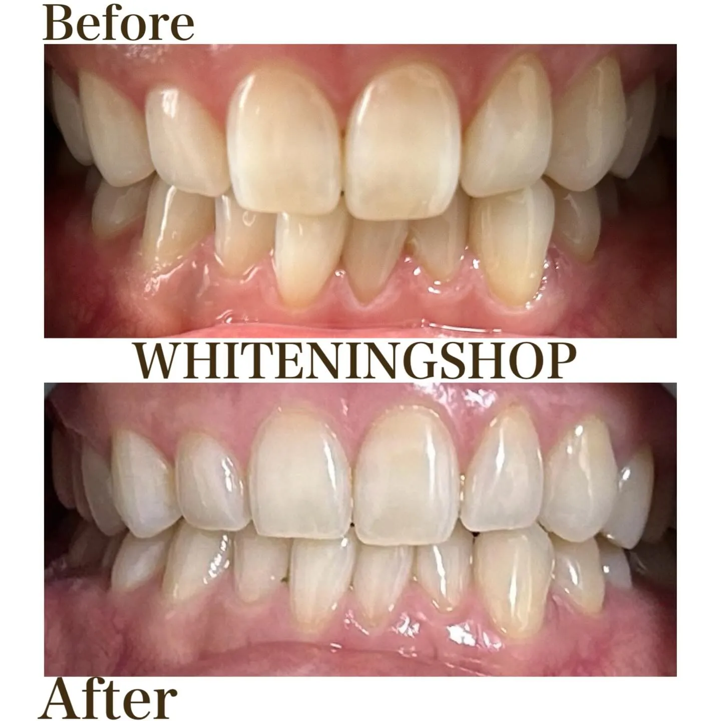 笑顔に、もう迷わない自分へ🪞✨