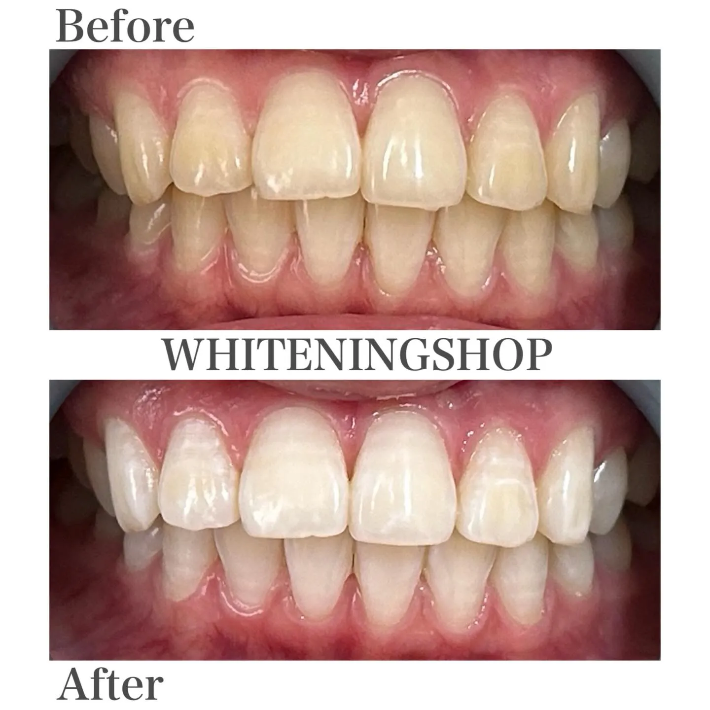 笑顔の印象は「歯」で変わる🦷✨