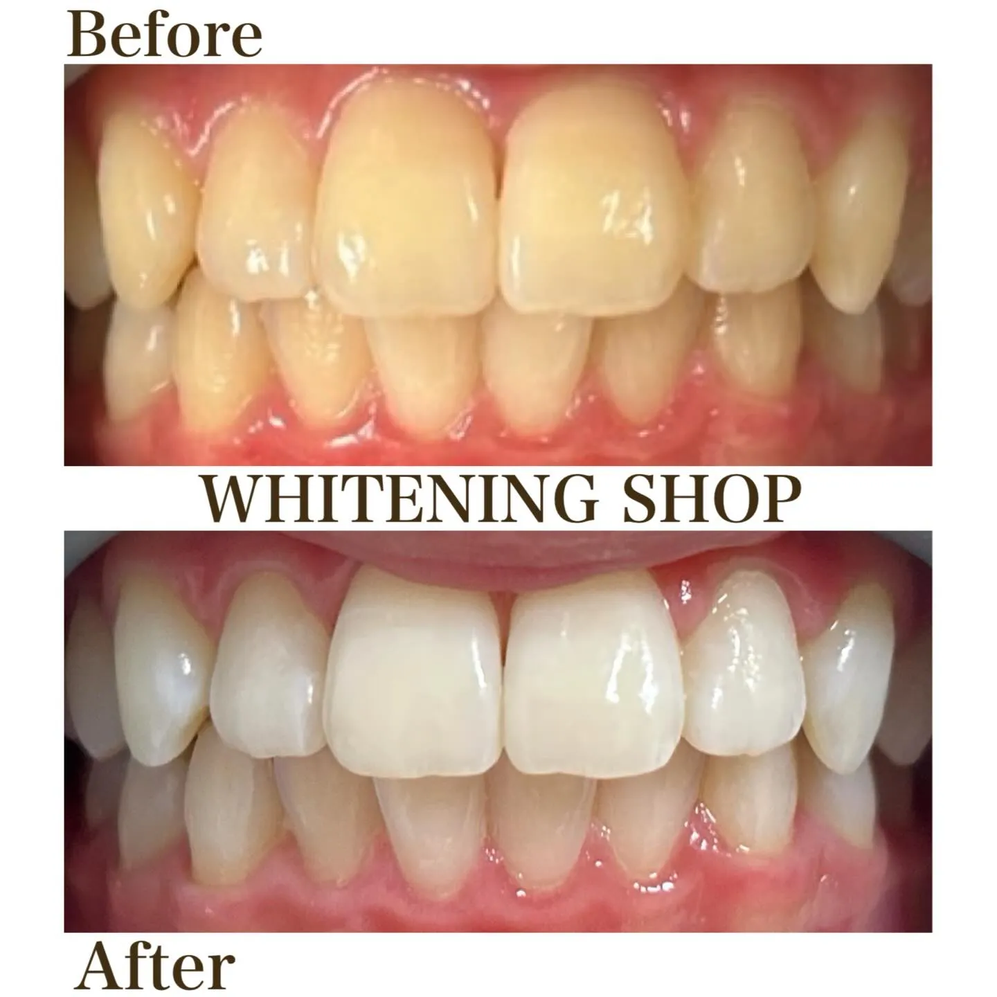 🌸第一印象は「歯」で変わる?🦷