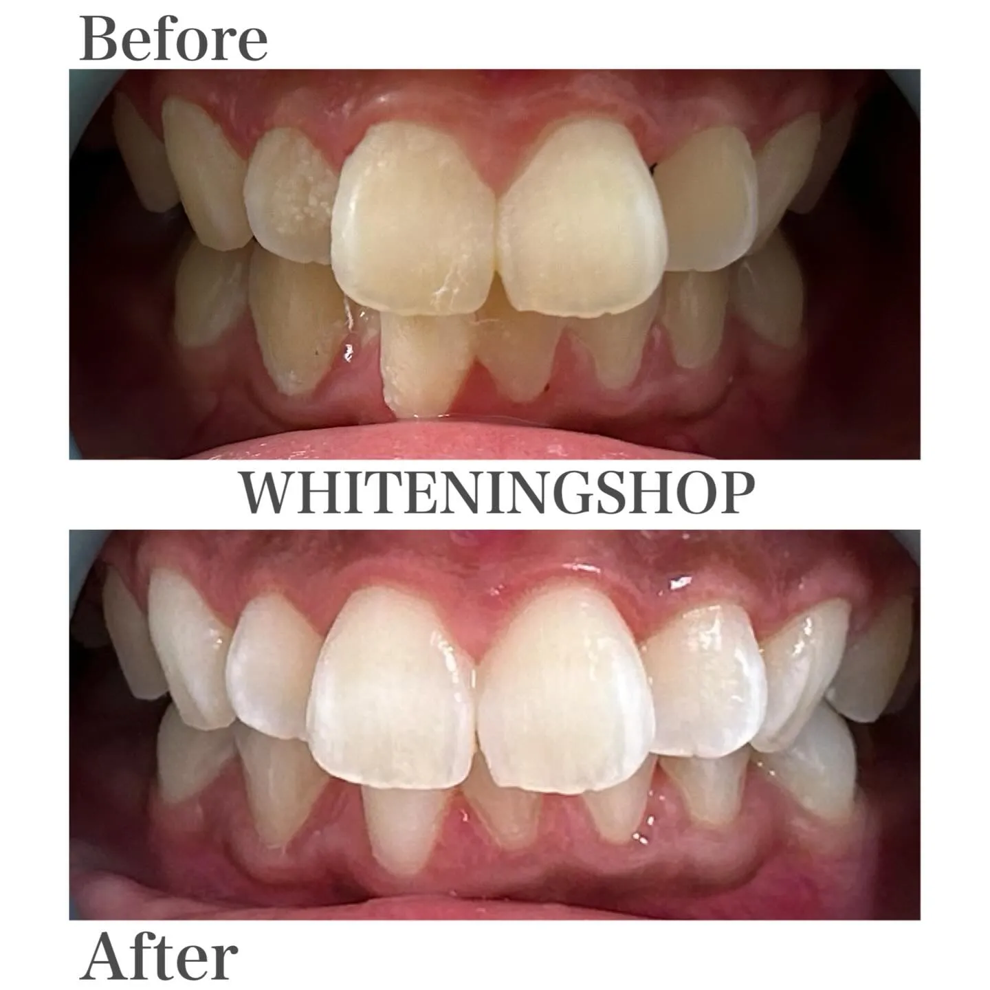 フィルターより先に整えたい“口元の印象”✨