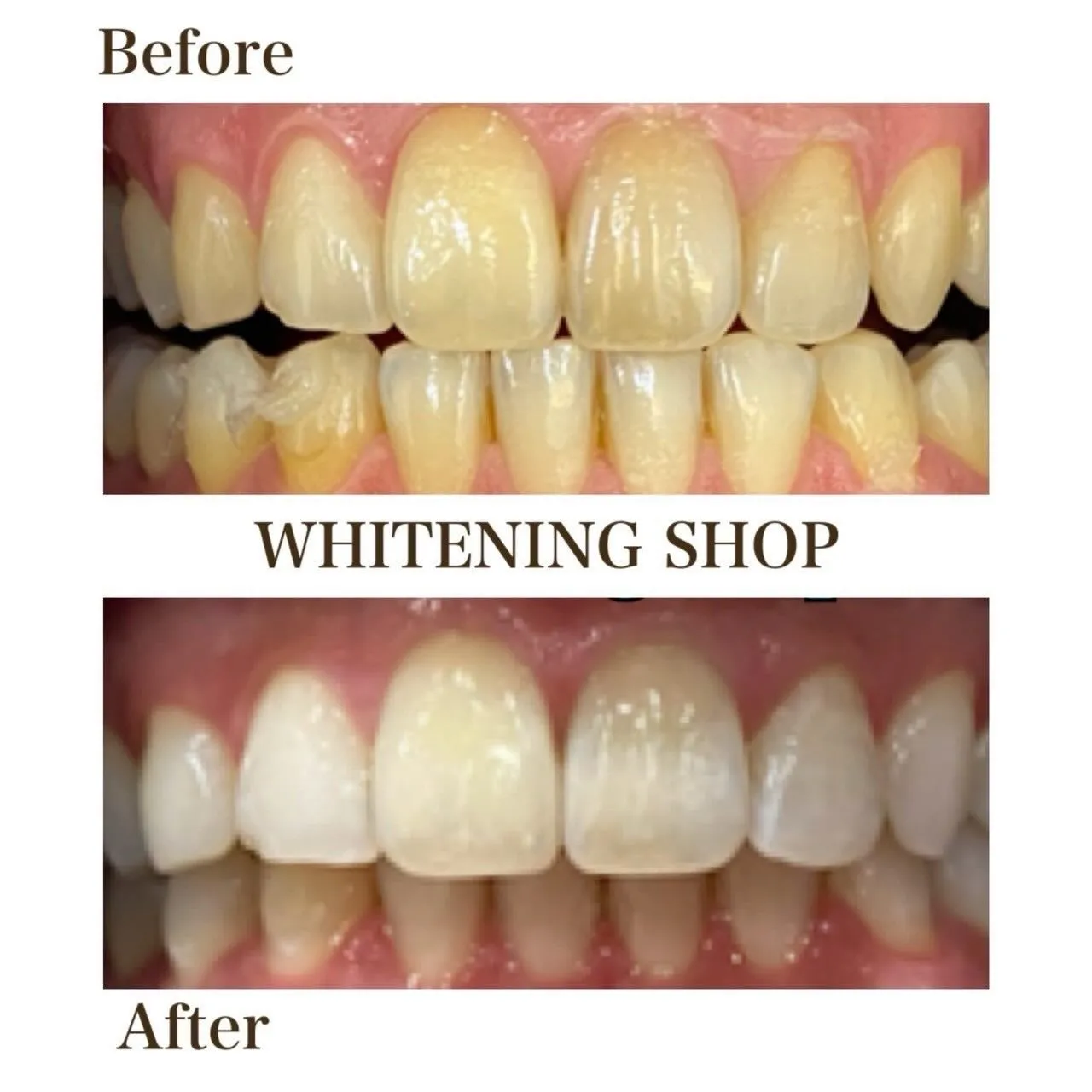 🤍口元が変わると、印象も変わる💫