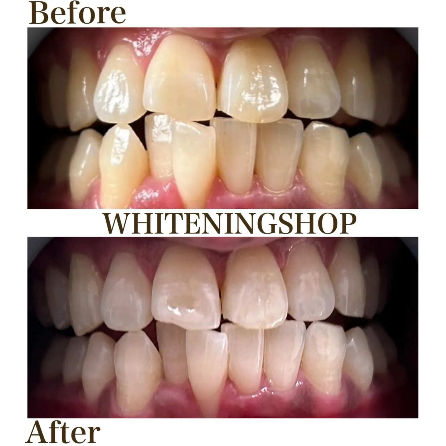 笑顔に、もう迷わない自分へ🪞✨