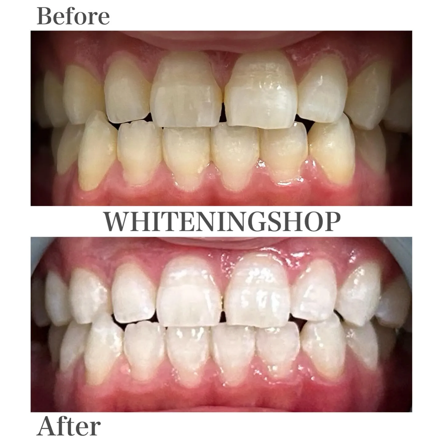 🌿自然な白さで、毎日に自信を🌿