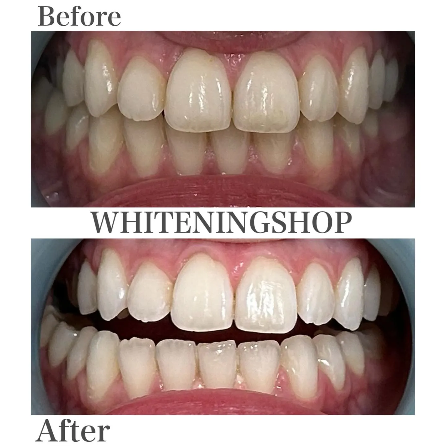 笑顔に、自信という輝きを💖