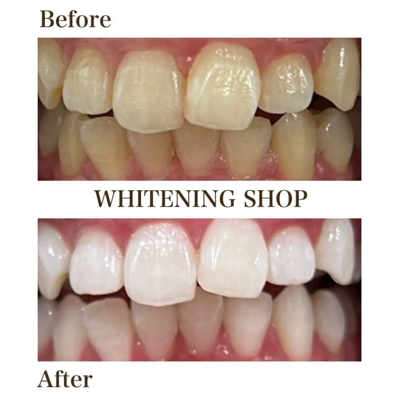 🌿 自分にやさしくする、白さ習慣 🌿