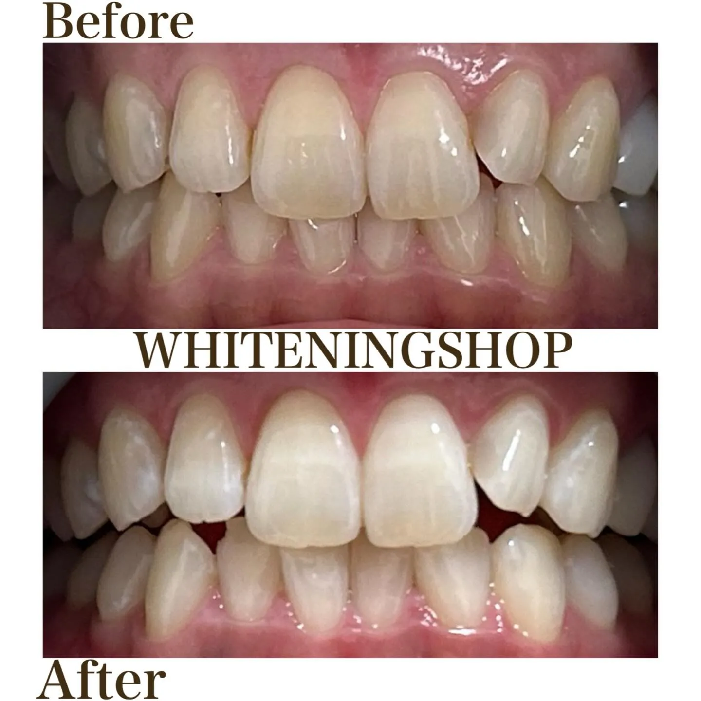 ぽかぽか春日和☀️笑顔もワントーンアップ✨