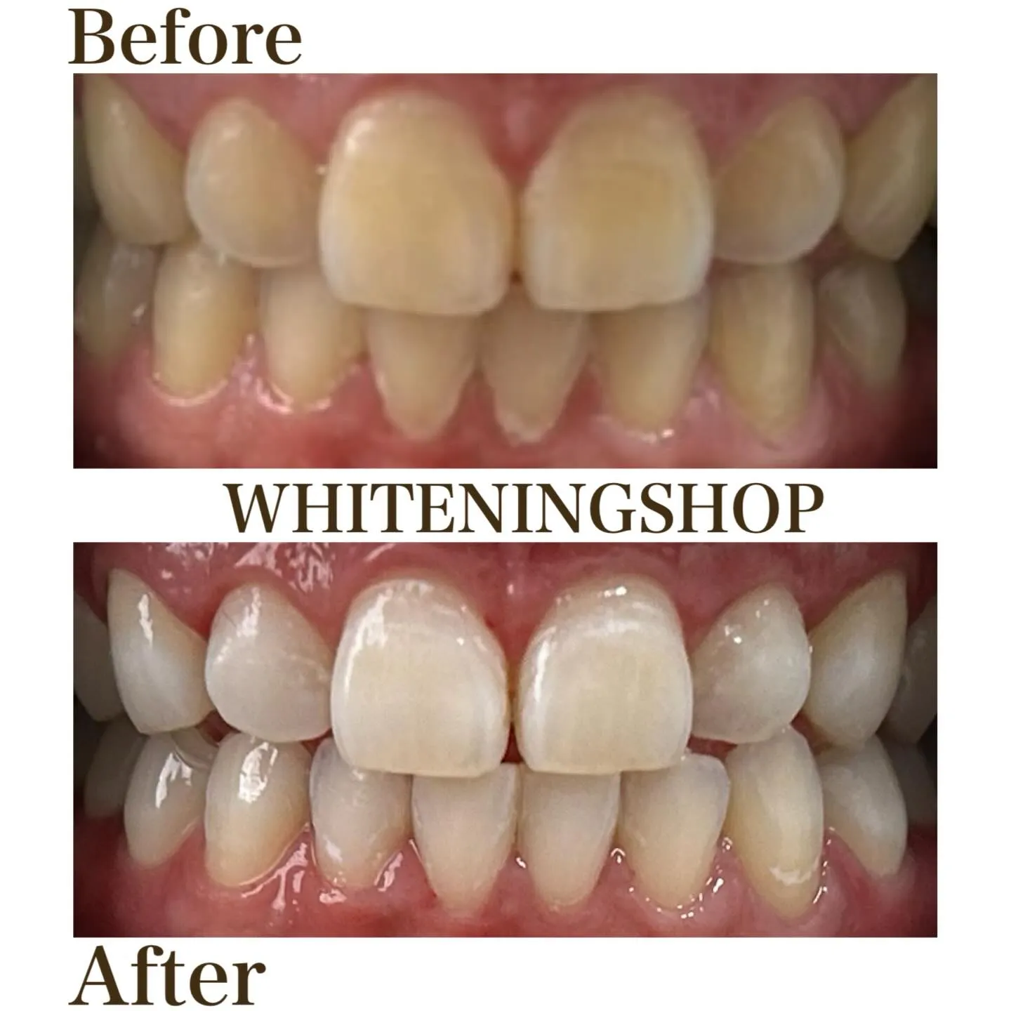 フィルターより先に整えたい“口元の印象”✨