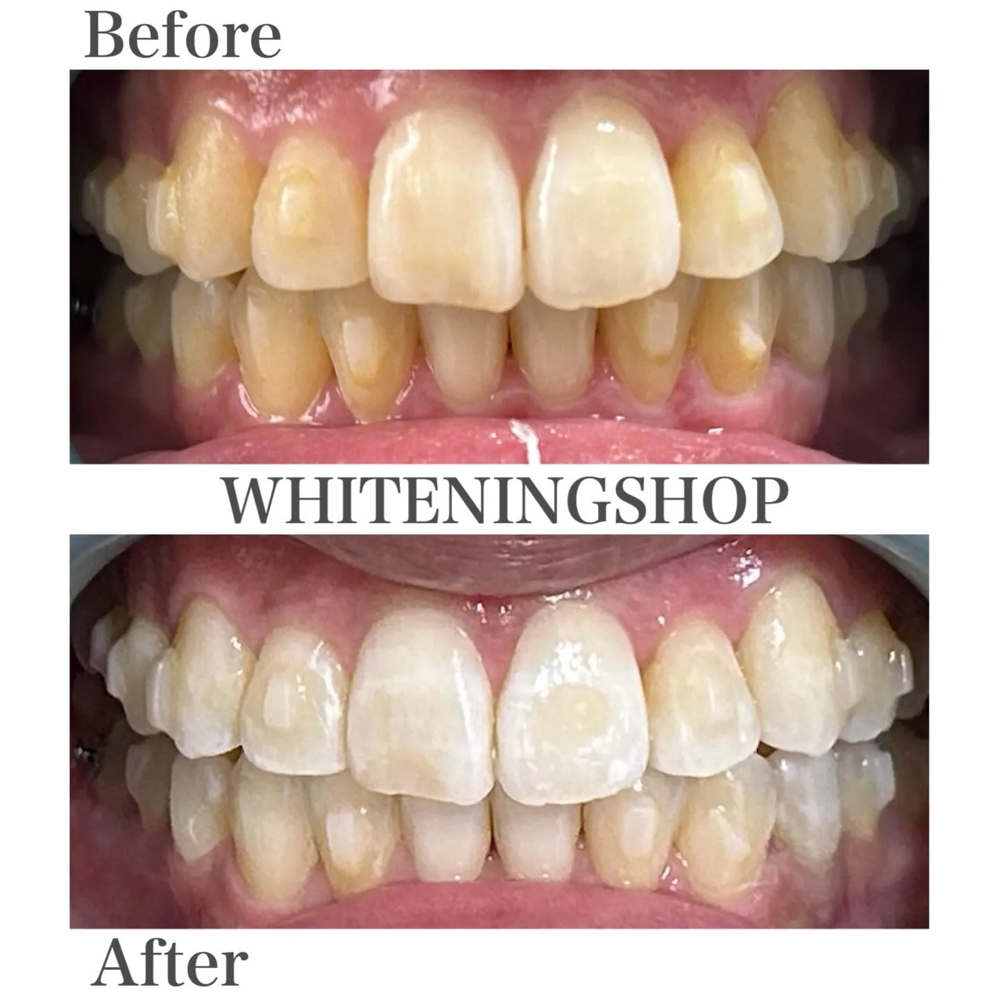 ふとした瞬間に差がつく、口元の印象😌💭