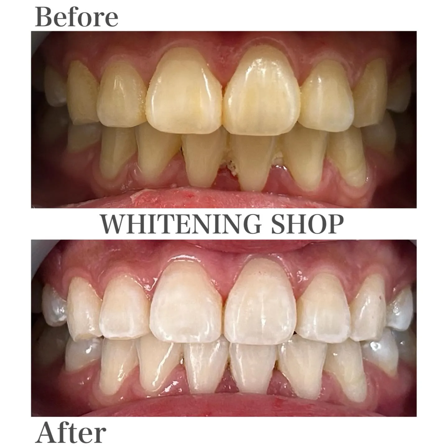 笑顔に、もう迷わない自分へ🪞✨