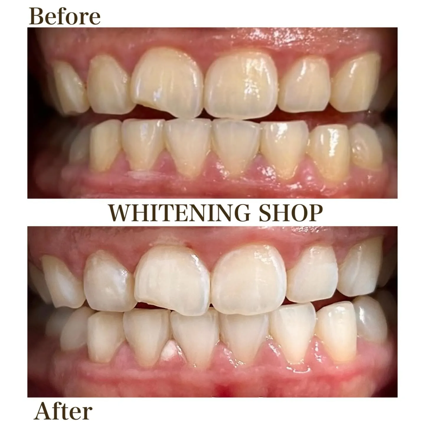 ふとした瞬間に差がつく、口元の印象😌💭