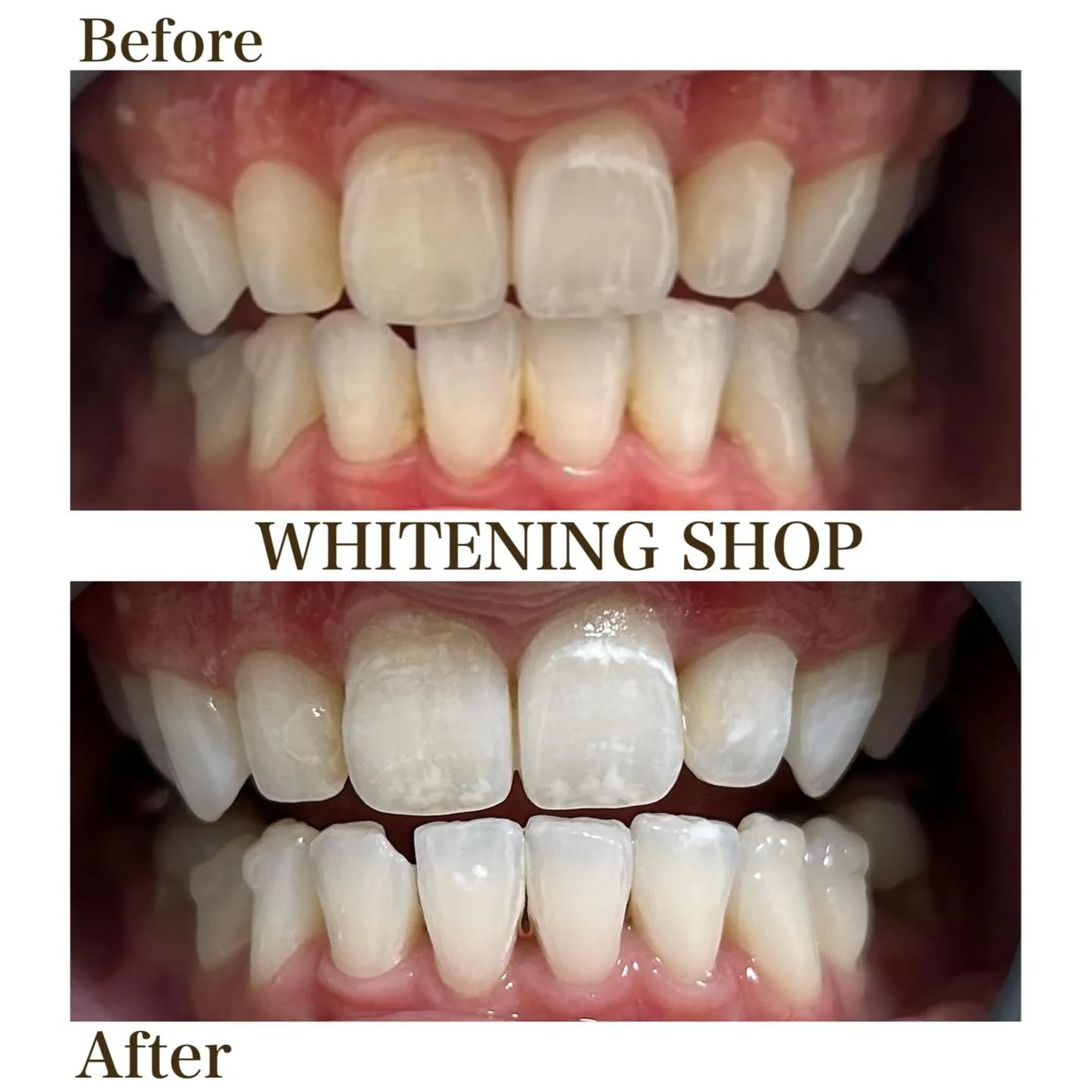 ふとした瞬間に差がつく、口元の印象😌💭