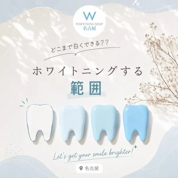 🦷✨ どこまで白くできる? ホワイトニングする範囲をご紹介 ...