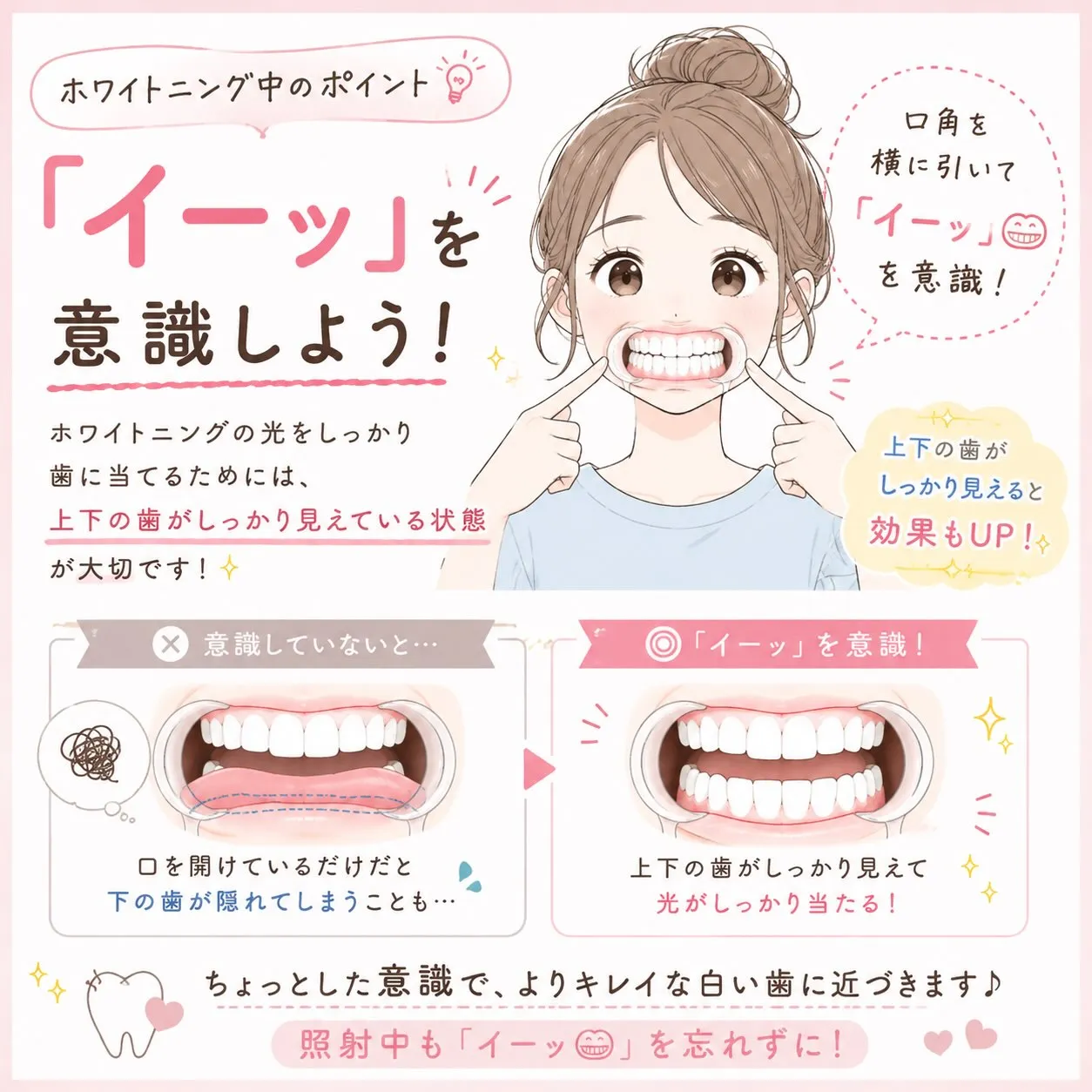 🦷🤍ホワイトニング中のちょっとしたポイント🤍🦷