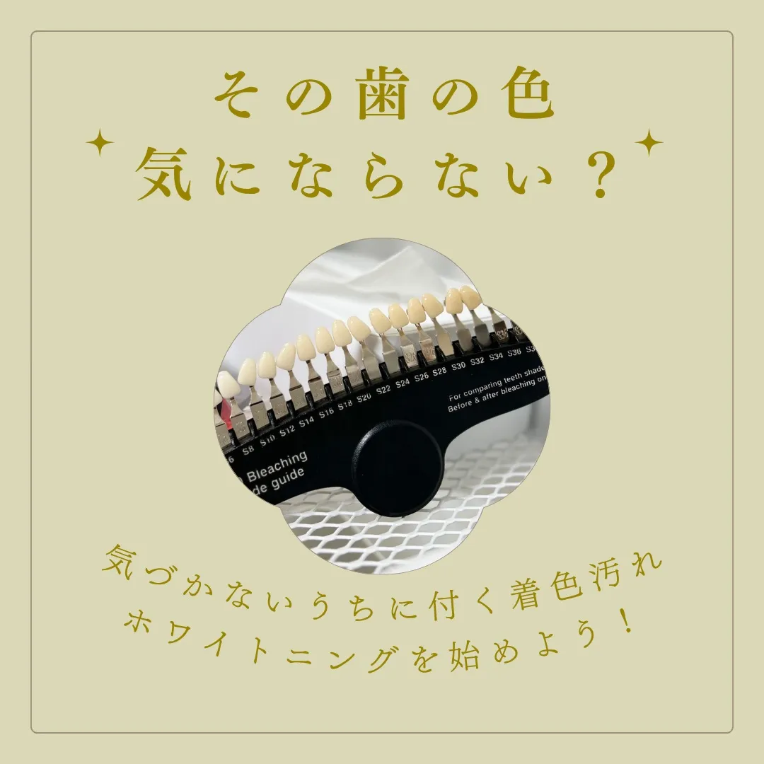 🦷✨「私の歯って、実際どのくらいの色?」
