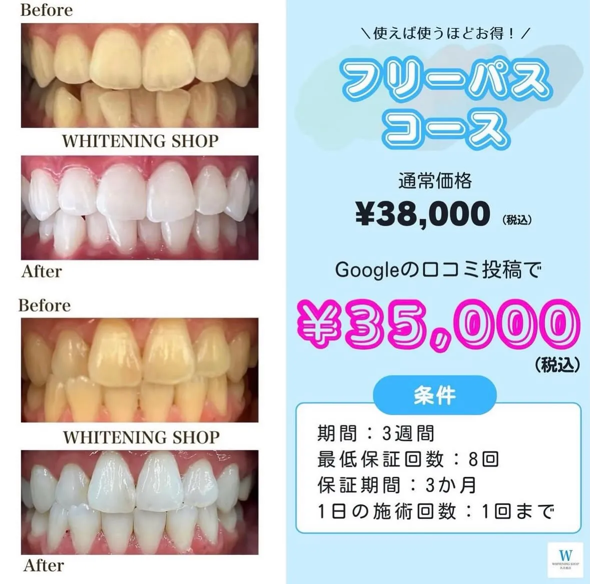 🦷✨ 通うほどお得!短期集中💎3週間フリーパス 💖
