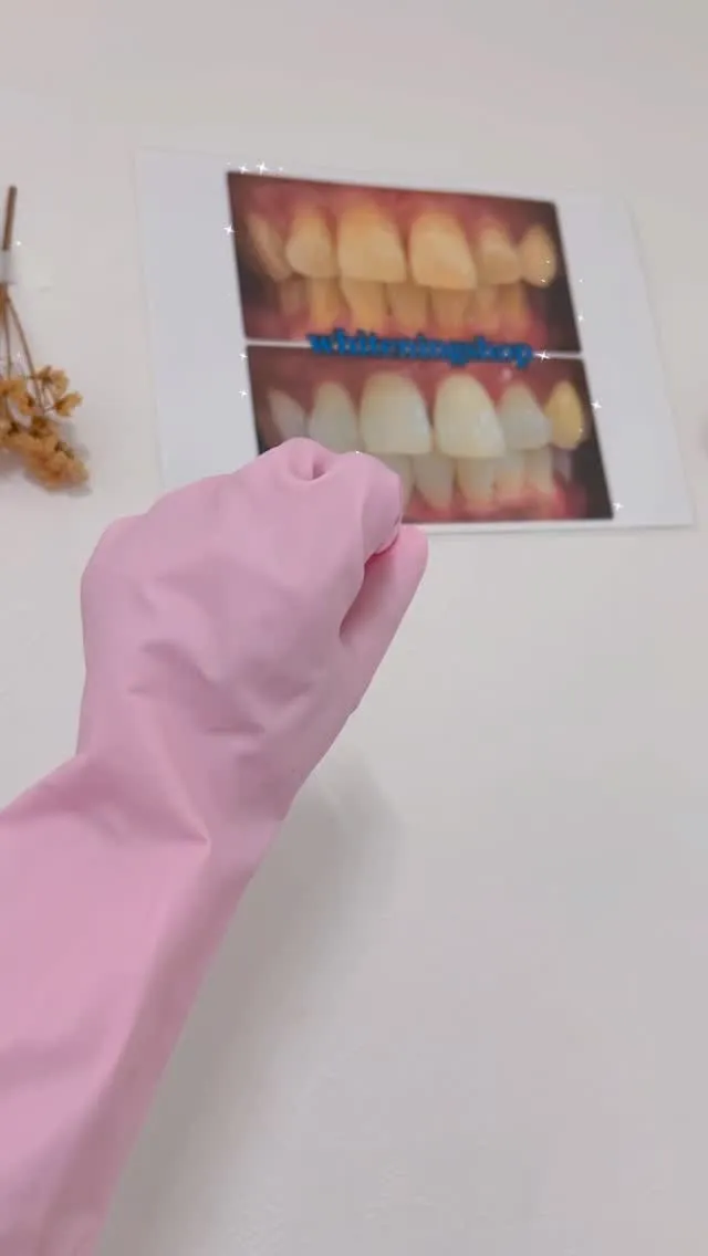 💗ホワイトニングショップ名古屋店💗